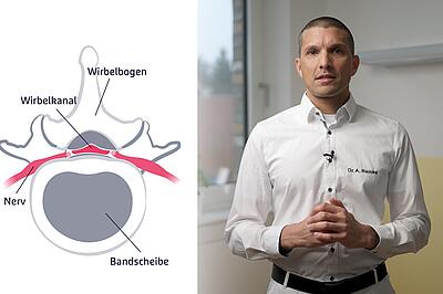 Klinik Vincentinum Augsburg Vorschau Spinalkanalstenose